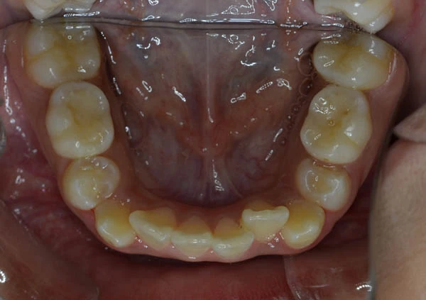 Before image