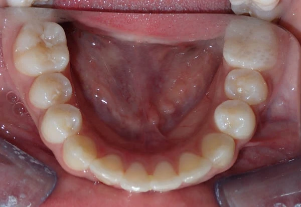After image