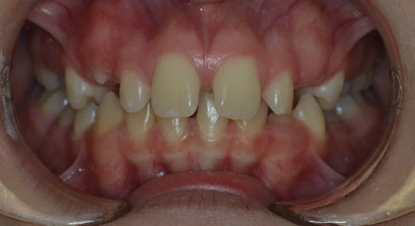 Before image