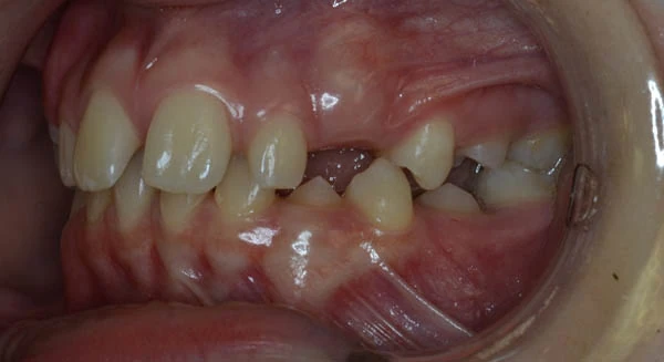 Before image