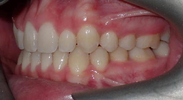 After image