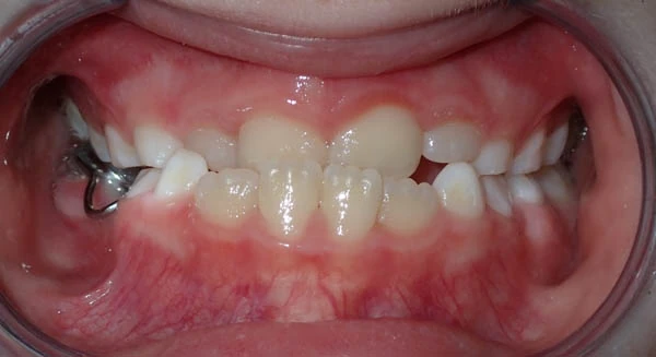 Before image