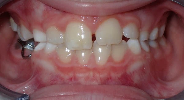 After image