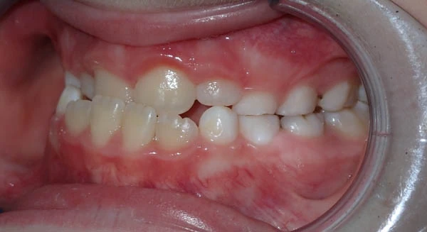 Before image