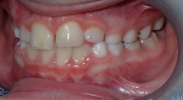 After image