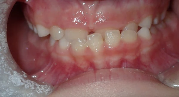 Before image
