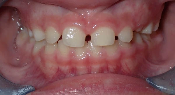 After image