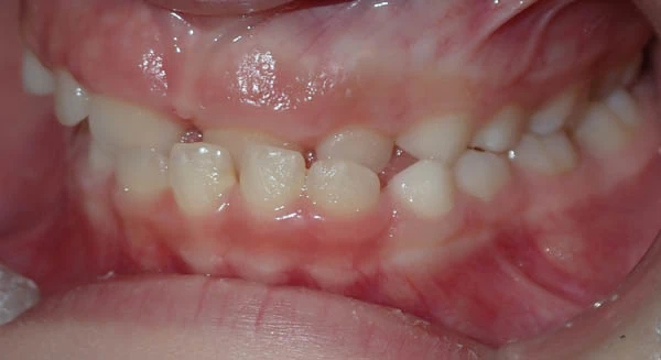 Before image