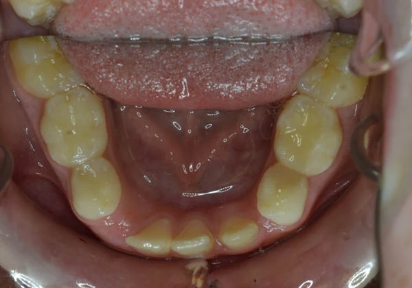 Before image