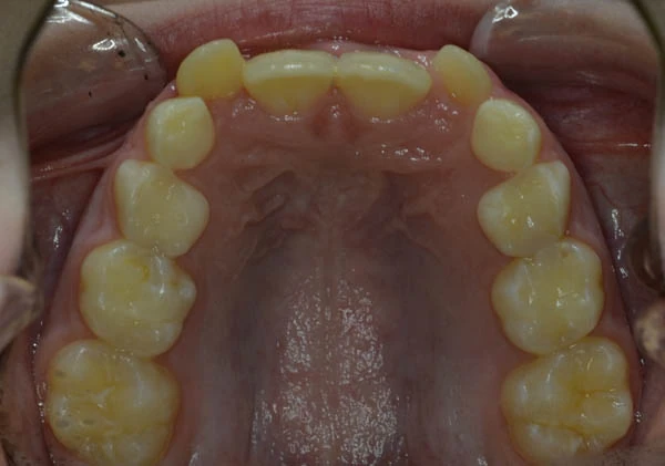 Before image