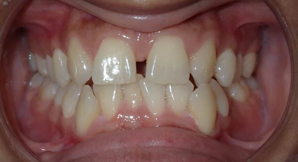 Before image