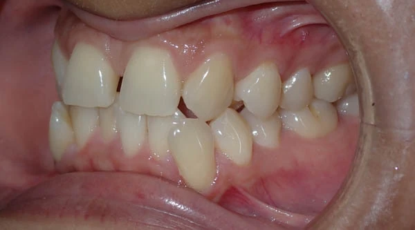 Before image