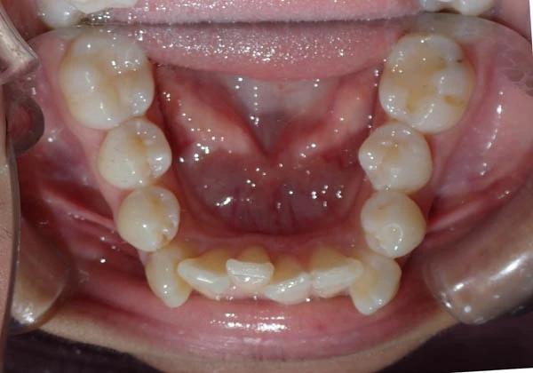 Before image