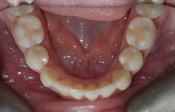 After image