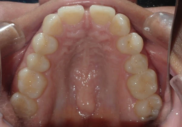 Before image