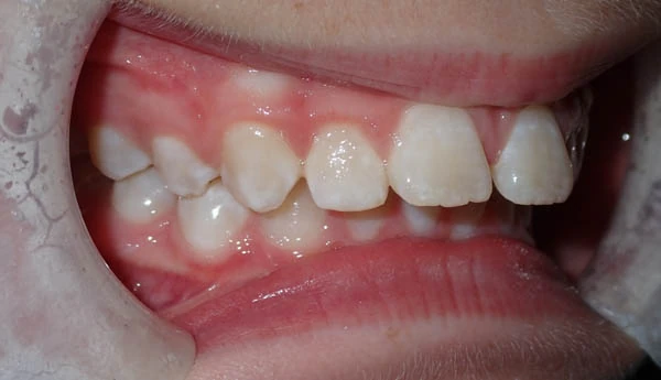 Before image