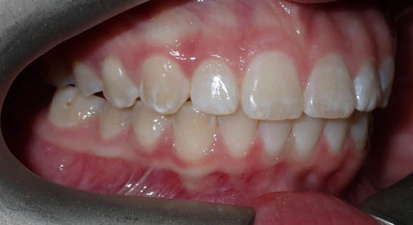 After image