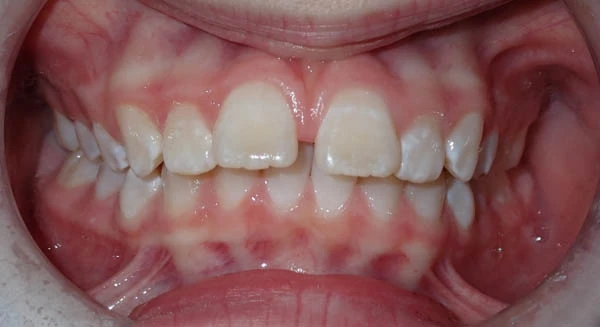 Before image