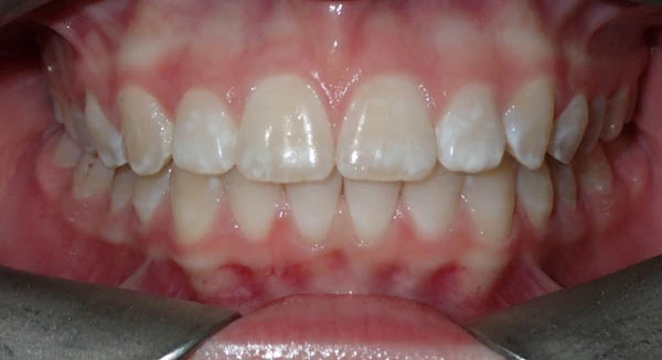 After image