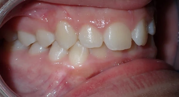 Before image