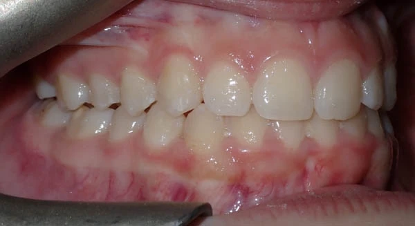 After image