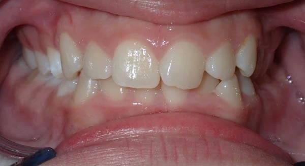 Before image