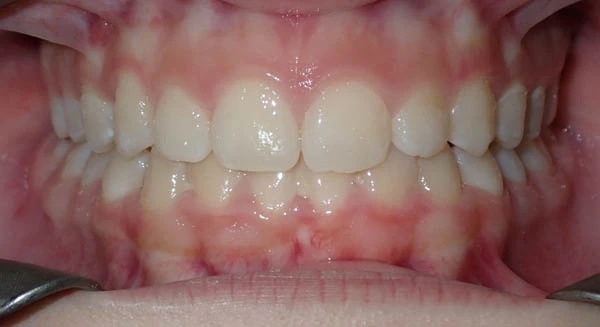 After image