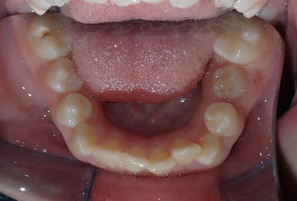 Before image