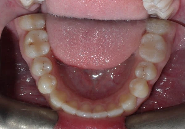 After image