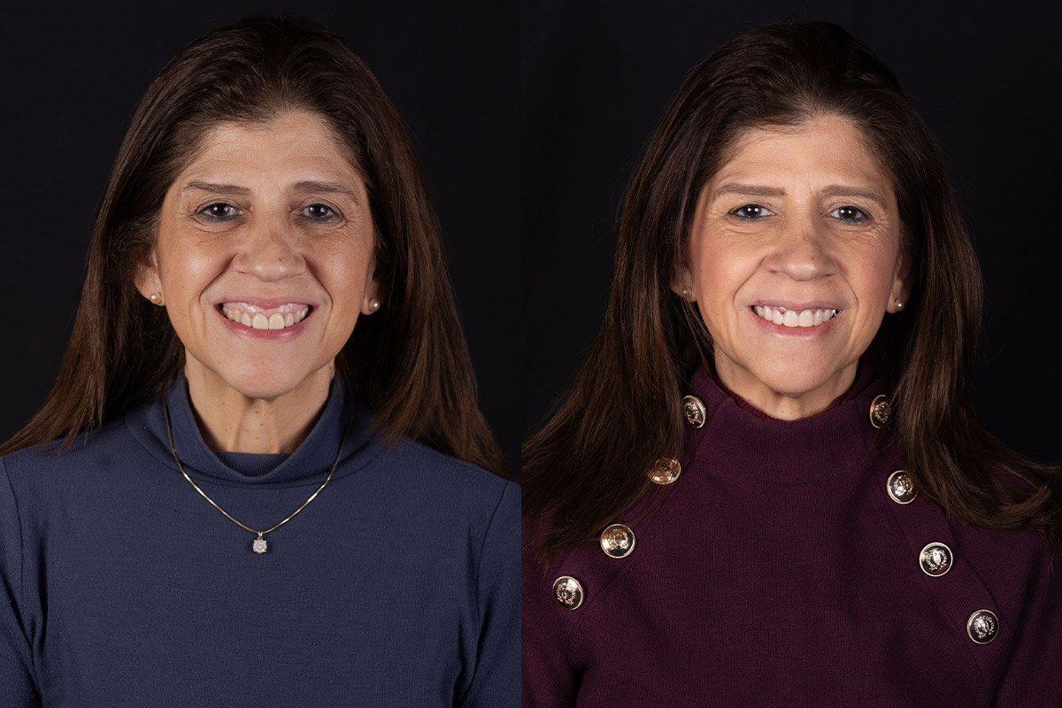 before and after look at dental results provided by Cochituate Smile Center